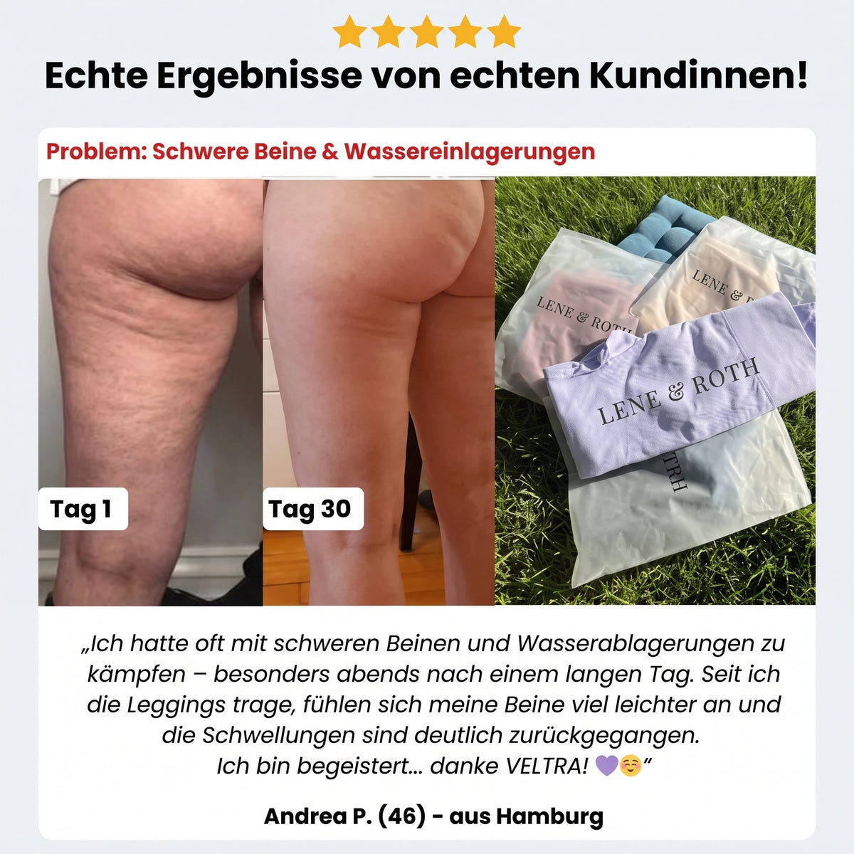VELTRA SmoothFit™ 3D-Kompressionsshorts 2.0 - Lene & Roth